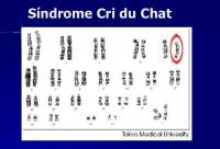 Bragato apresenta projeto para proteger pessoas com a s?ndrome ?Cri-Du-Chat?